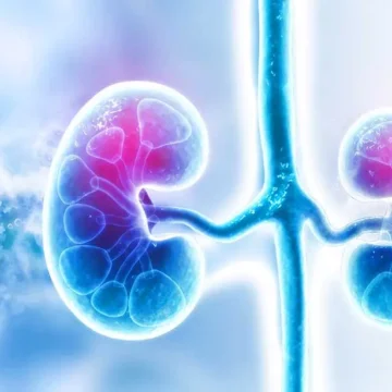 ნეფროზული სინდრომი